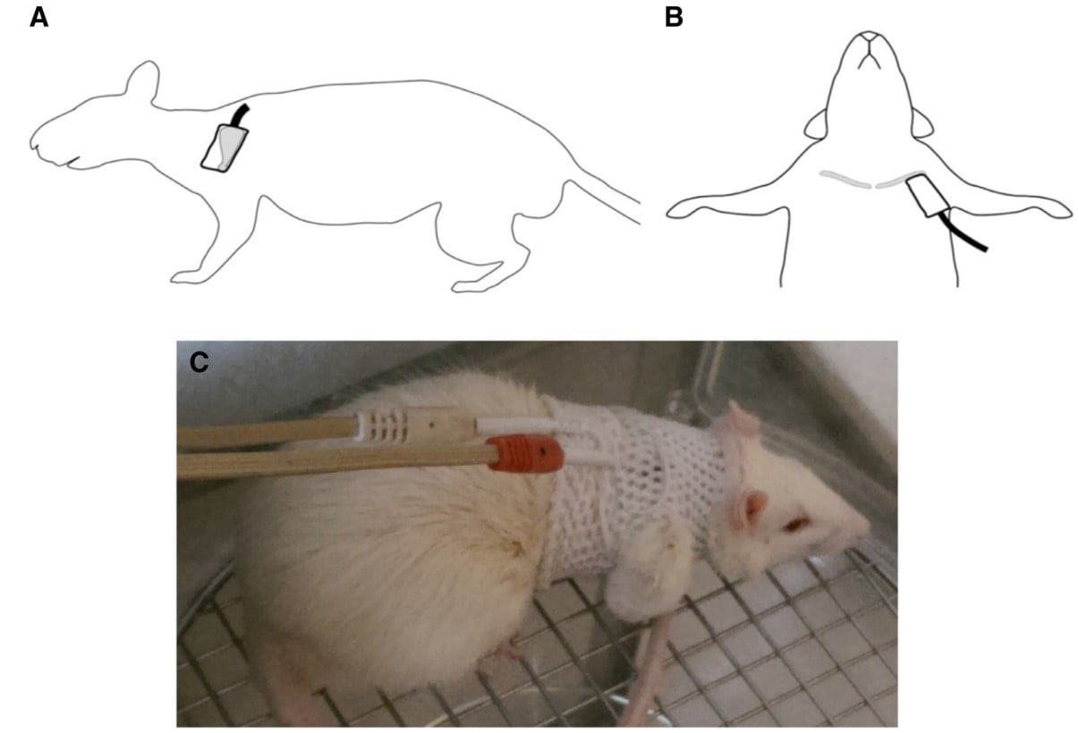(CS Huang et al., Auton Neurosci., 2019)