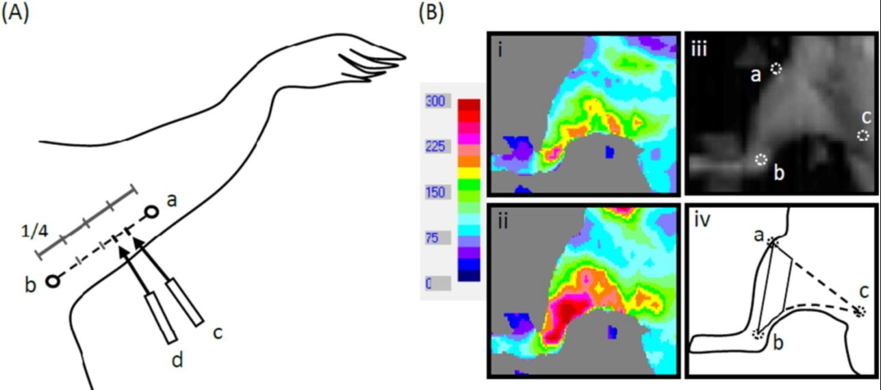 (CS Huang et al., Microvasc Res., 2017)